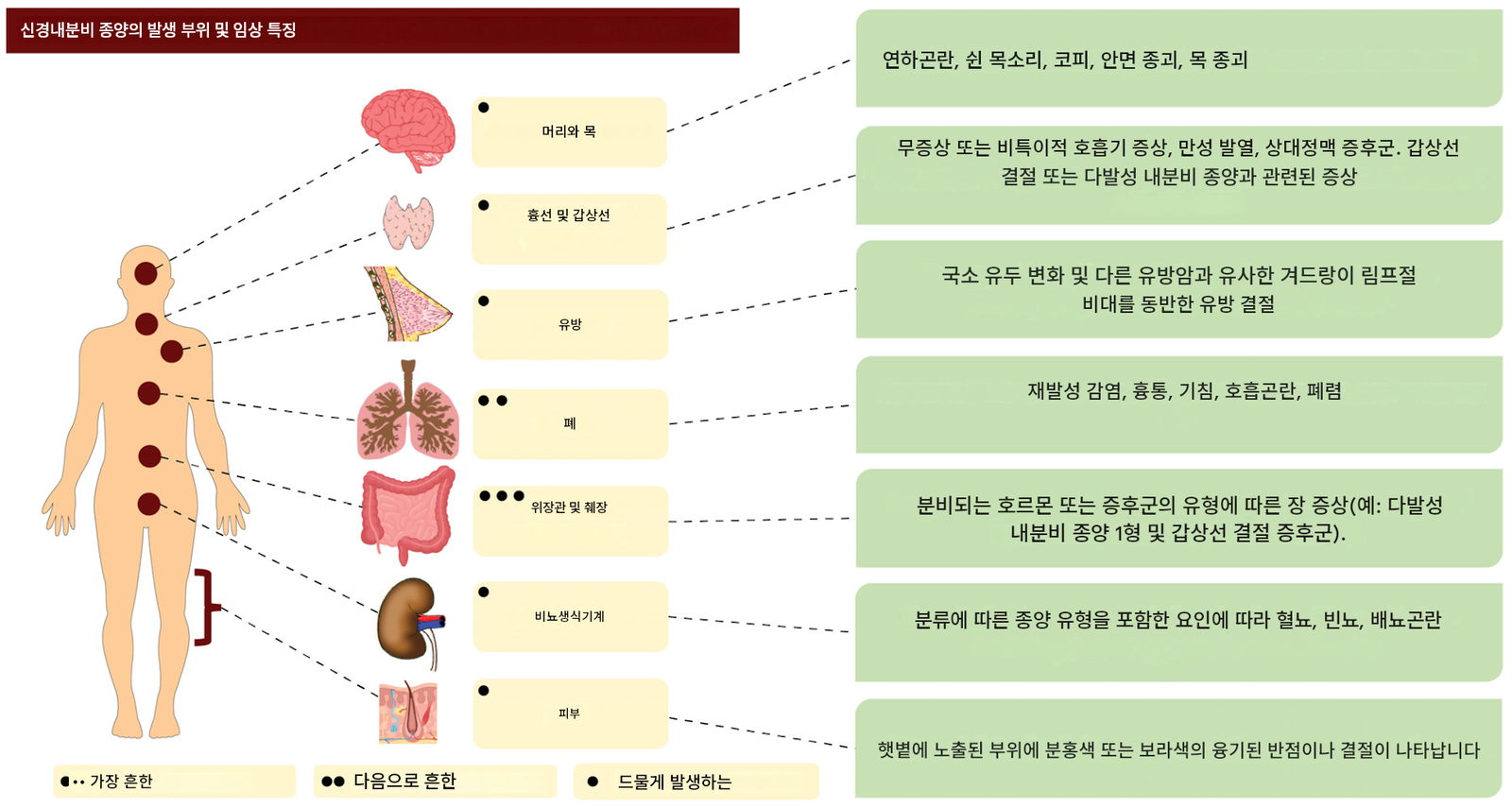 신경내분비신생물 주요 호발 부위 및 임상 특징 다이어그램